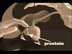 Sasha-Anatomía de ma ...